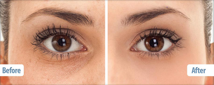 kem mắt tốt cho tuổi 30 có thành phần đặc trị
